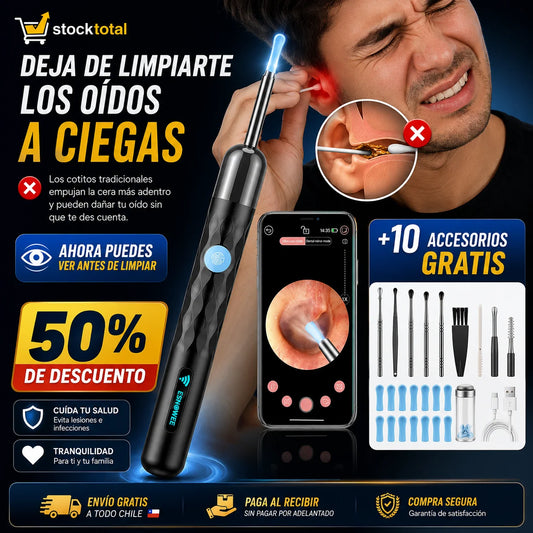 Limpiador de oídos con cámara Cámara HD | 50% de DESCUENTO Y ACCESORIOS GRATIS